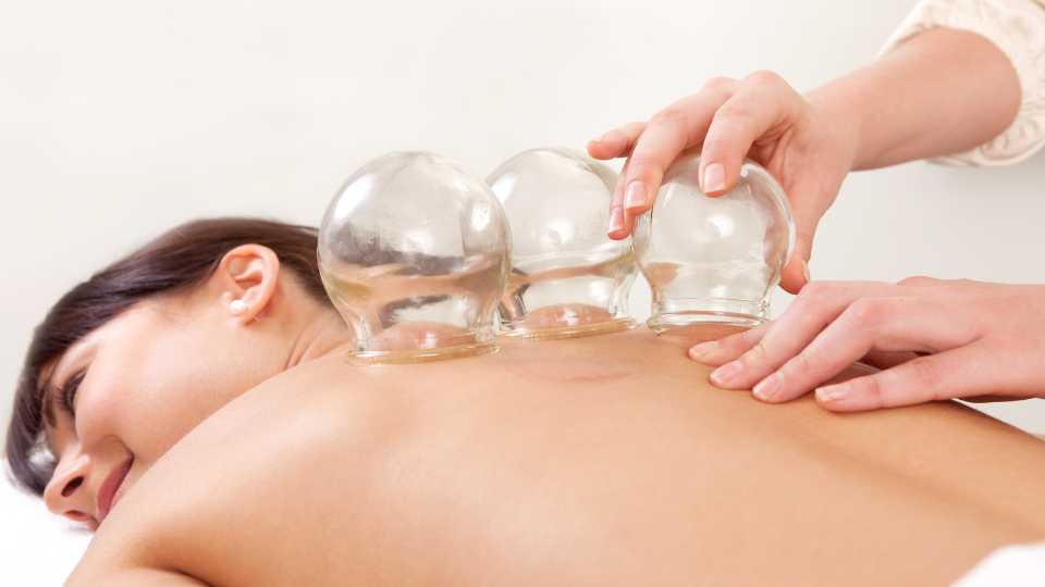 fire cupping Liverpool (1)